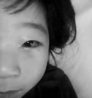 河北5岁女孩幼儿园被男子打 眼角膜破裂(图)