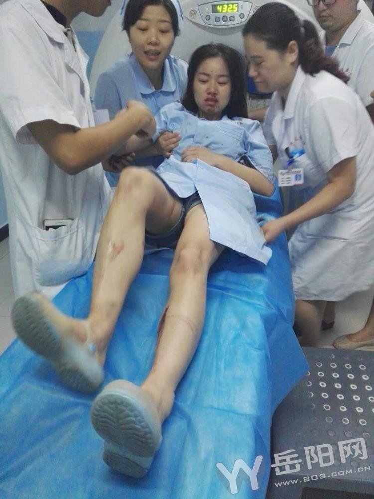 救护车遭车祸 美女护士口鼻流血坚持救病人