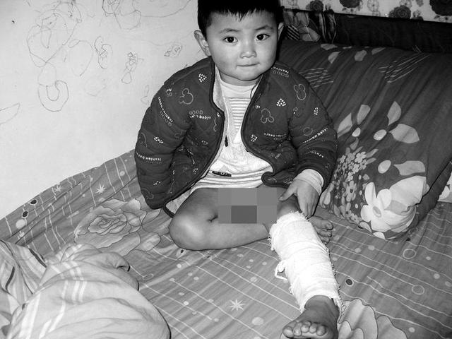 眉县4岁娃幼儿园里摔骨折 记者采访遭阻挠