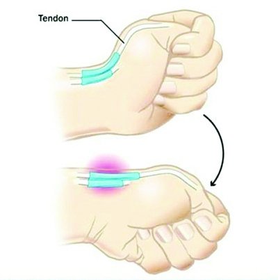 微博传 智能手机中毒测试图 专家称有道理