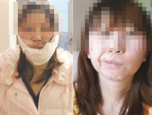 歪嘴女人视频恶搞,歪嘴女人视频恶搞版