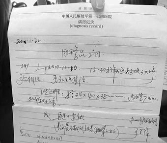 医生太忙误把处女当妇女 b超仪器破处女膜