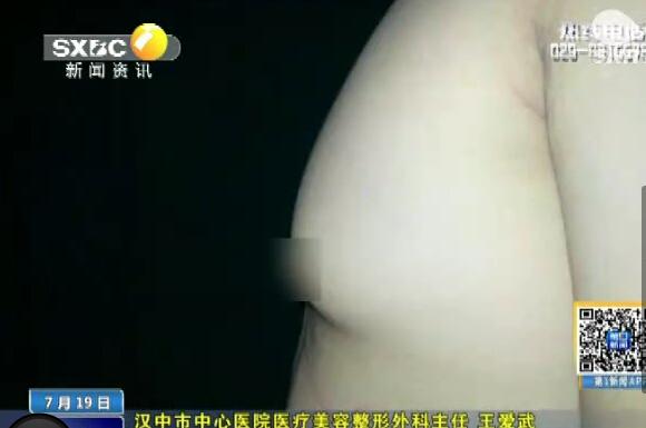 <em>17岁</em>少年<em>胸部发育</em>如女性 疑摄入激素过量惹祸