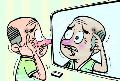 老大爷脸上长了小黑痣 反复抠挠成了恶性肿瘤