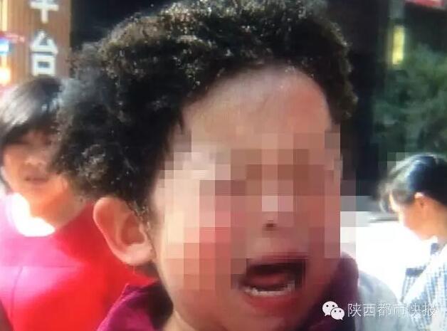 西安街头庆典大气球爆炸 俩孩子头发被烧