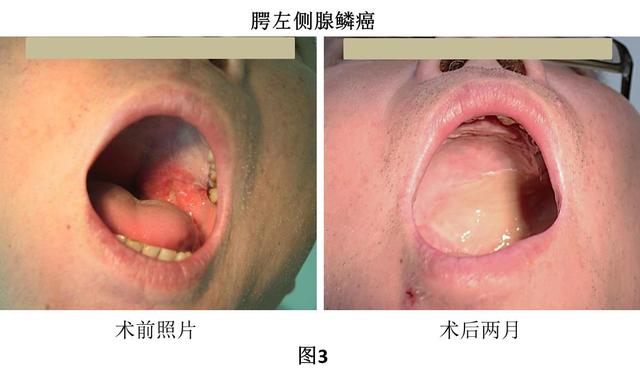 章丘私人口腔_章丘大葱(3)