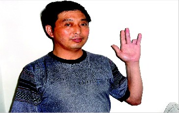 民工在矿区被砍断手指 行凶者自首当日保释_大秦网_腾讯网