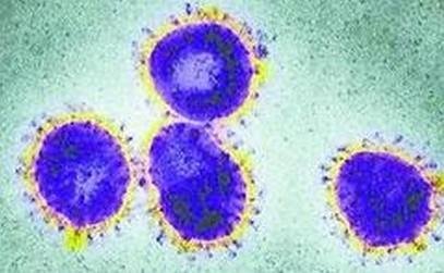法国发现首例新型冠状病毒病例 与非典同一类