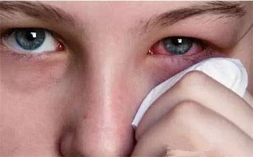 20多岁的年轻小姑娘因眼睛红肿发痒而就医,却在检查时意外发现睫毛上