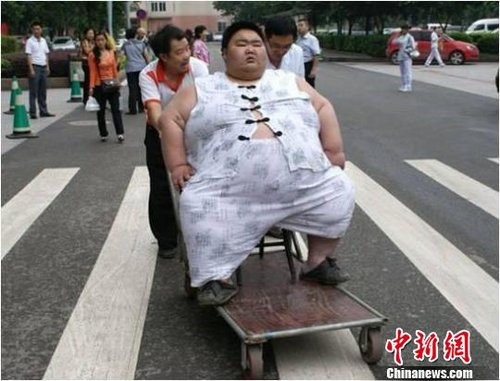 中国第一胖 男子就医 一年减肥81公斤