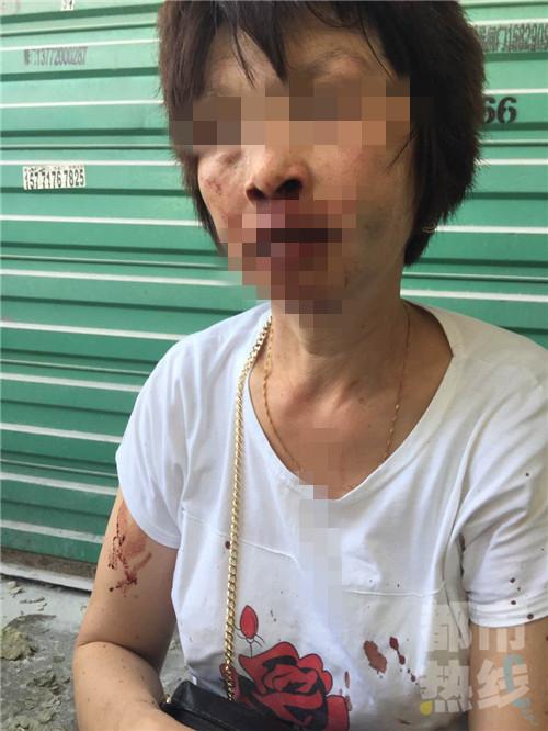 店铺转让引起经济纠纷 女子被对方拳打脚踢受