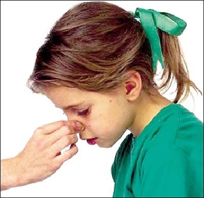 4招教你区别鼻炎和感冒