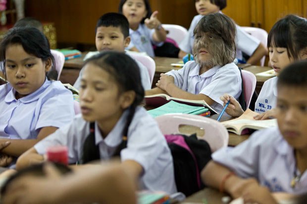 女生:泰国11岁小女孩组图浑身被称狼女二头肌长毛练肱图片