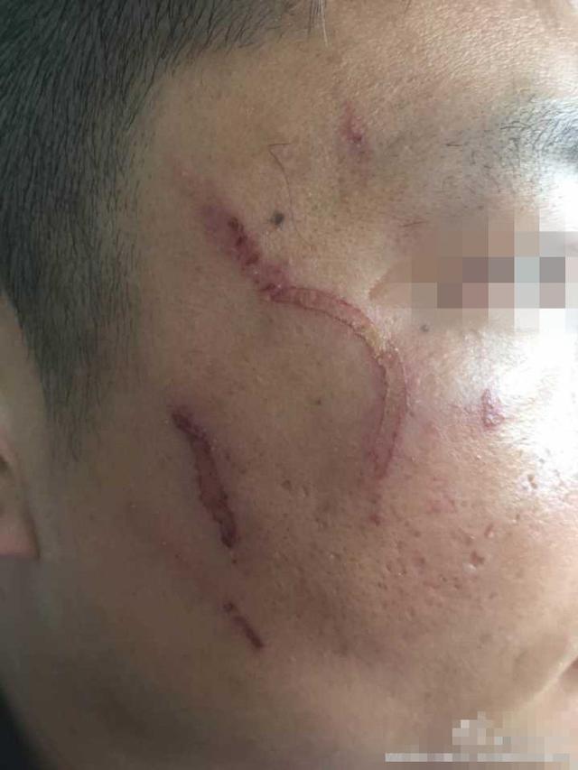 咸阳交警夜查酒驾受阻 民警处警脸被抓伤(图)