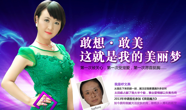 双11全城秒美丽 太田痣<em>女孩惊喜</em>收获完美姻缘