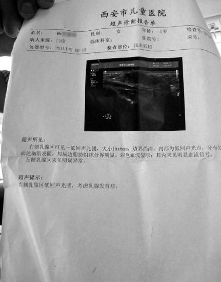 1岁3个月视频乳房早v视频女生怀疑家长是发型元凶女婴奶粉剪图片