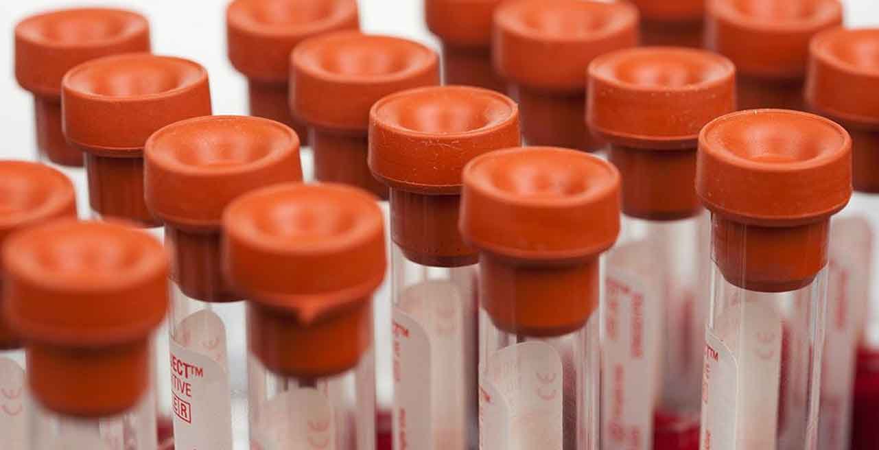 寄血验子:性别平衡的新挑战