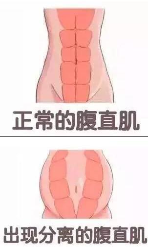 爱博恩医学护理·引领产妇瘦身新浪潮