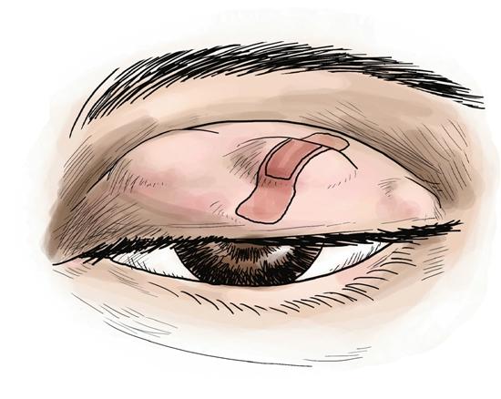 女子花三千八纹美瞳线 眼睑溃疡双眼红肿流泪_大浙网_腾讯网