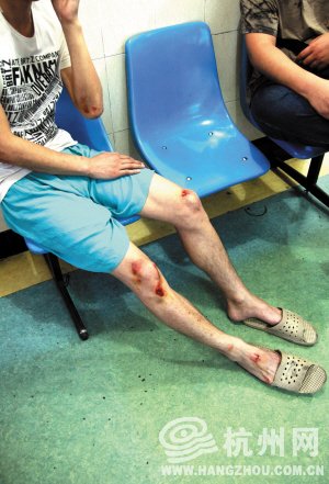 男子因停车纠纷被砍 事发时抱着8个月大的女儿