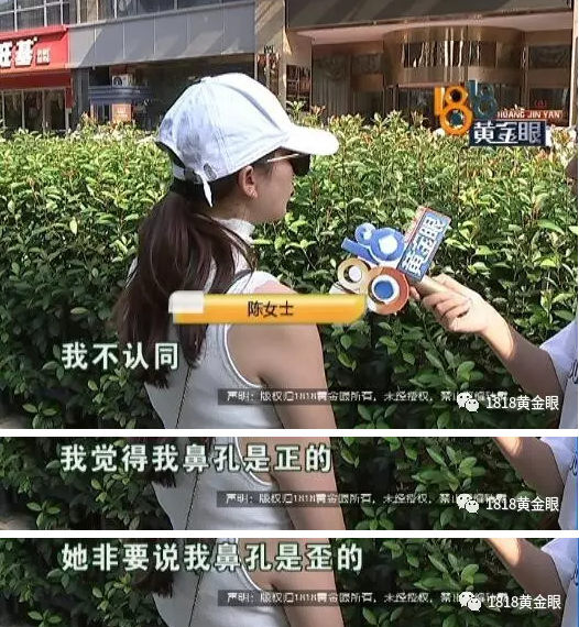 杭州一女子去做了隆鼻手术 结果两个鼻孔不对