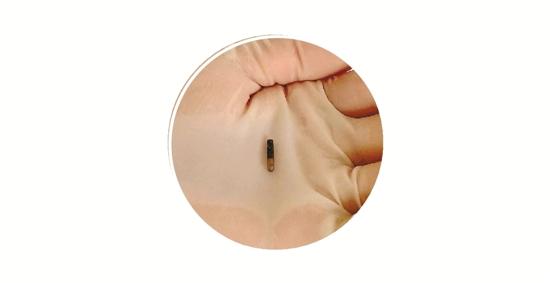 狗狗体内植入电子芯片 提前进入智能时代?