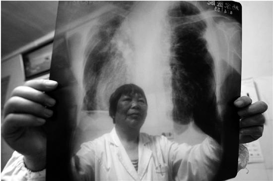 金华发布职业病报告 尘肺、职业中毒比例最高