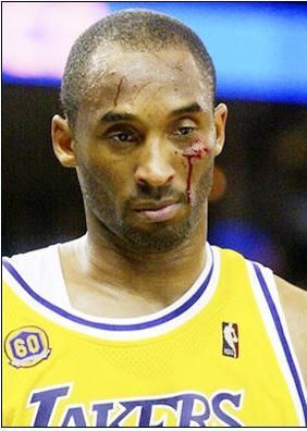 盘点科比带伤比赛担架抬出更衣室血洒赛场