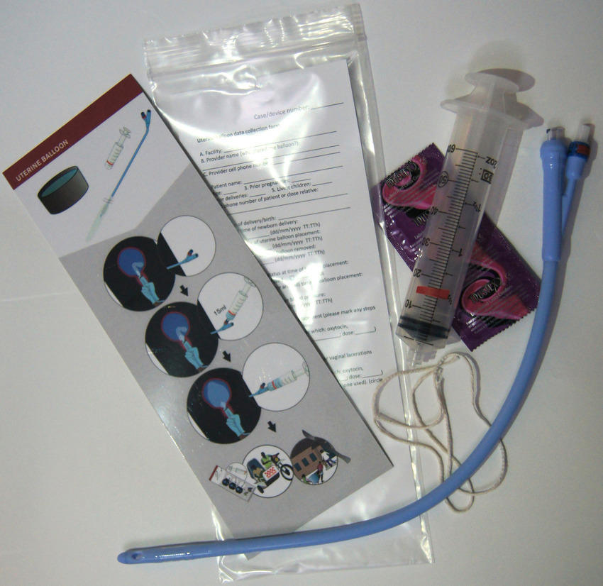 低成本子宫球囊填塞.