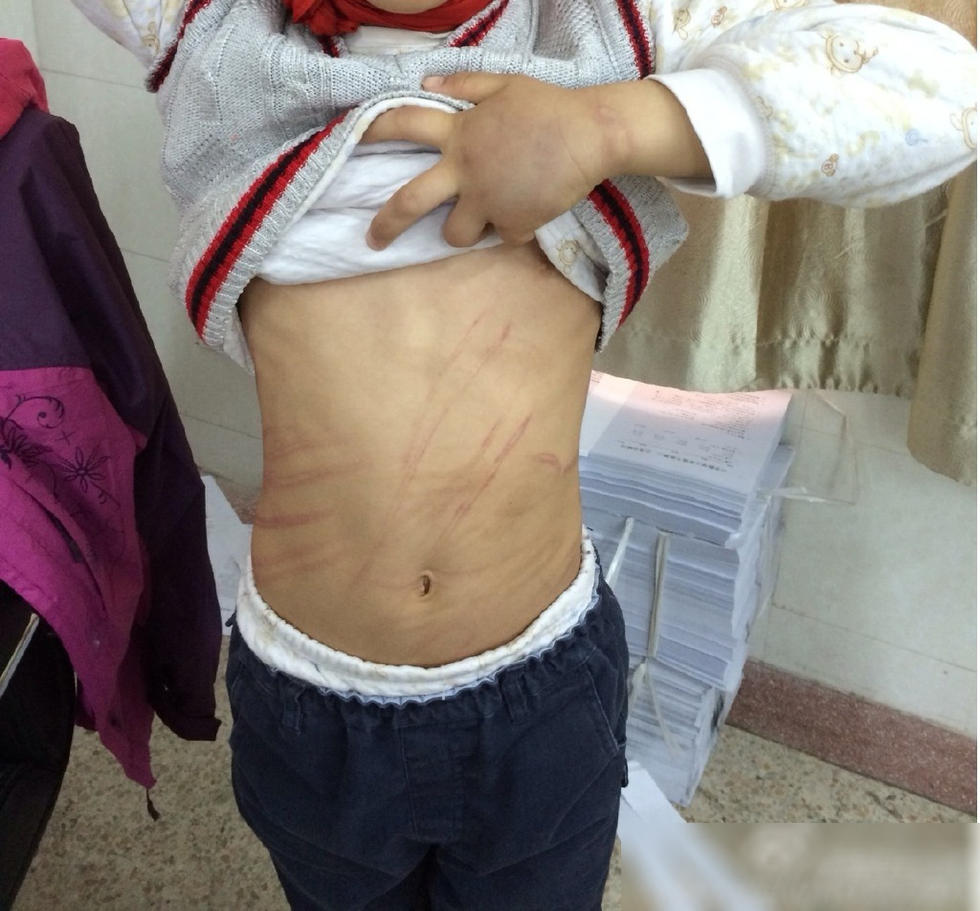 南京一对父母虐待9岁养子 : 男童的养父母都是高知