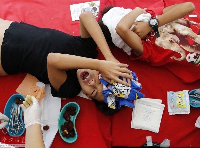 组图:菲律宾300名少年在学校课桌进行割礼