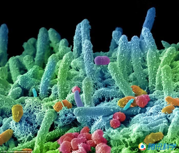 这些"细菌怪兽"生活在你的口腔里