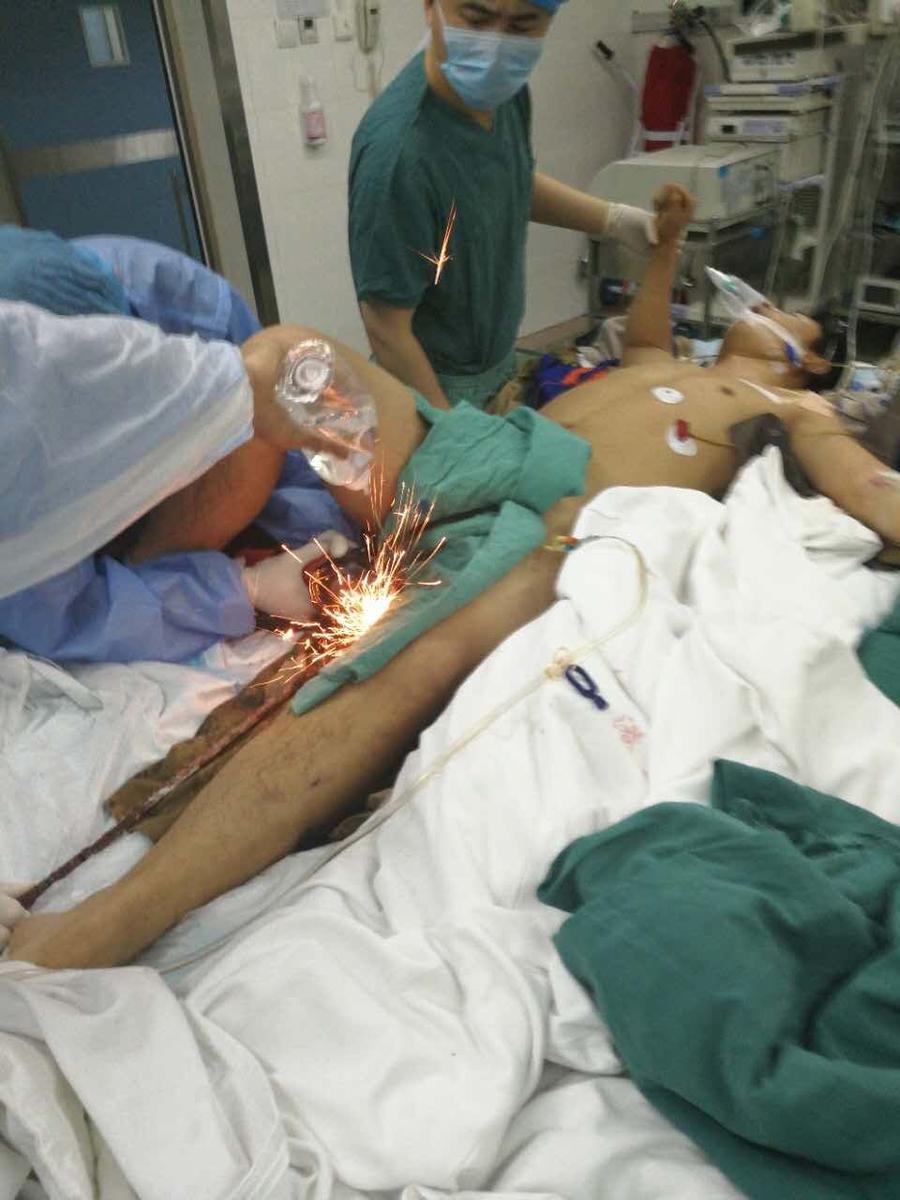 工人被钢筋贯穿身体 郑州消防,医生跨年夜接力救治