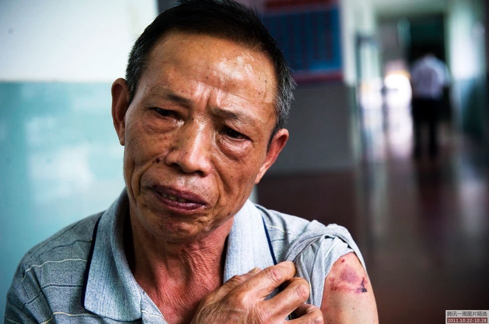 10月24日,在派出所,看到左胳膊上被儿子咬开的血肉,老人非常伤心.