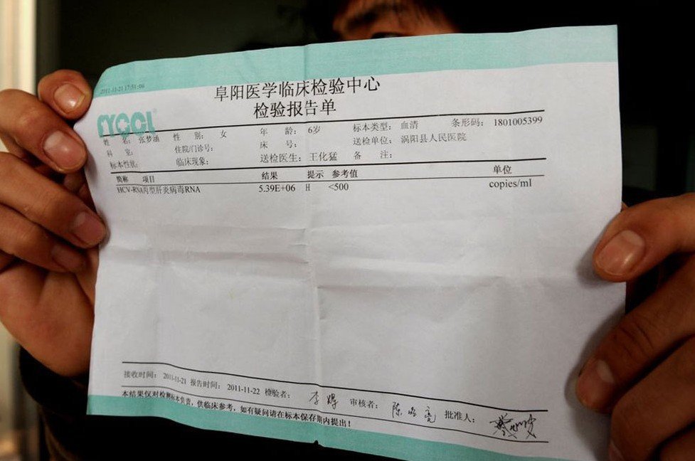 组图:安徽多名儿童感染丙肝 疑针头使用不当