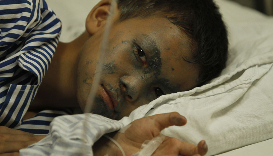 11岁的小学生钟荣兴全身红肿,满脸银灰色油漆,连牙缝都有残存.