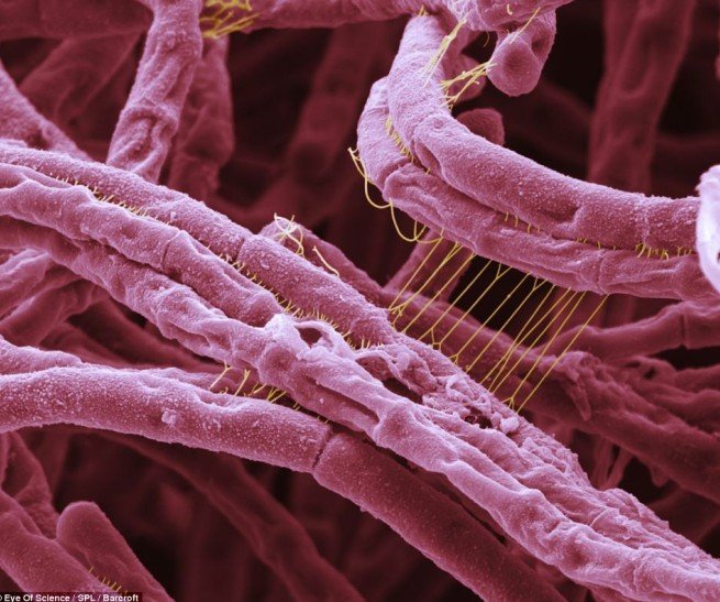 细菌恐怖吓人图片