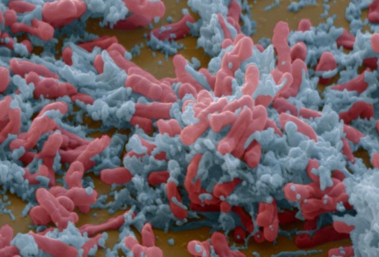 世界上最致命细菌的真面目