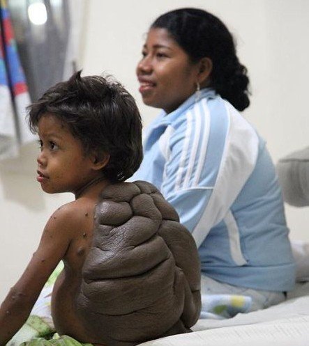 让人匪夷所思的儿童怪病