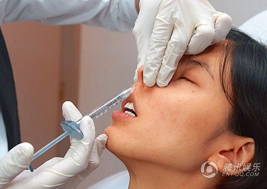 港姐陈思齐整容照曝光 注射过量透明质酸脸变形