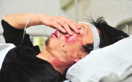 正文 南充私家侦探调查公司私人侦探 的哥酒吧门口被保安群殴 只因未