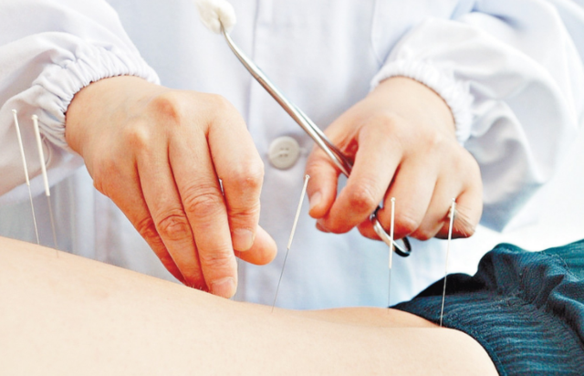 顶级西医杂志挺中医:针灸治女性尿失禁靠谱