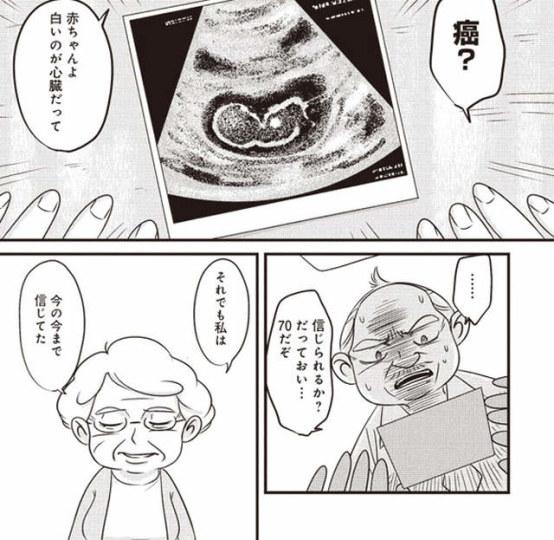 70岁怀孕生子 岛国网络漫画老年夫妻受关注