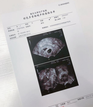 就开始备孕,等了一年迟迟没有怀上,她去当地的公立医院进行宫腔镜检查