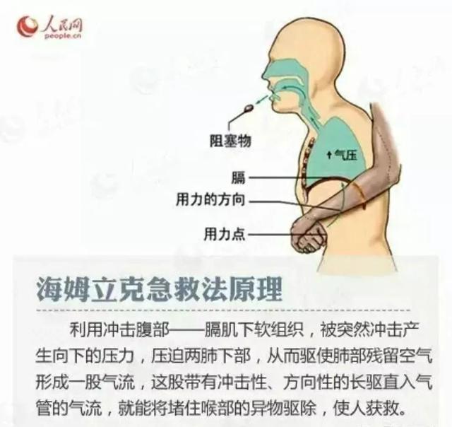 碰到儿童异物卡喉，家长到底怎么做？