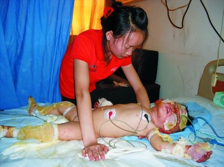 门反锁房子起火 女婴惨遭烧伤未脱离生命危险