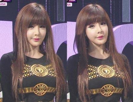 [明星新闻]2ne1成员朴春娃娃脸不自然 被疑整容失败(图)