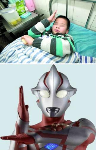 重庆男孩模仿奥特曼从6楼飞下