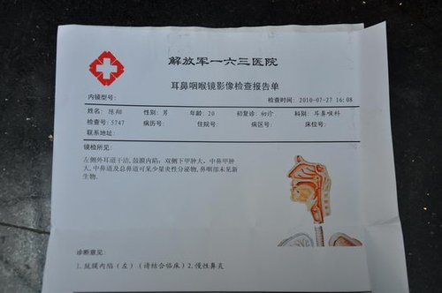 陈翔听力受损 患神经性耳聋