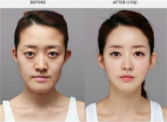 韩国推整容认证书 因旅客整容前后差异大